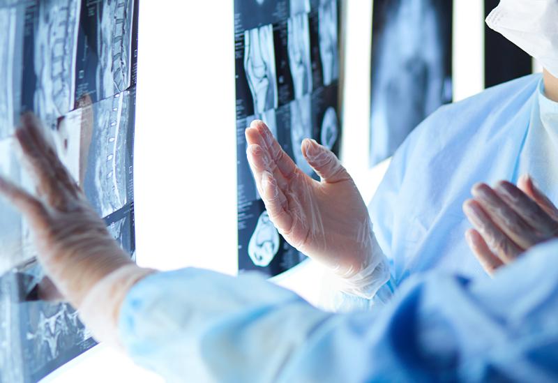 doctors looking at xrays